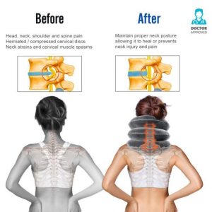 Cervical Neck Traction Neck Stretch Brace Cervical Posture Corrector - Image 3