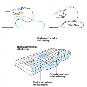 Cervical Pillow for Neck Pain Relief - Image 7